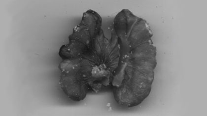 film still: Scan of a walnut. I really enjoyed doing this sequence. I used lots of scanned nuts to mimic the grainy, surreal look of the image you see whilst the foetuses are being scanned with ultrasound.

