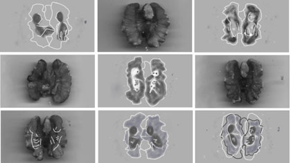 film still: Montage of walnut images. In one of the images you can see the foetuses pushing each other – during a scan we actually saw our twins kicking and pushing each other inside my belly.

