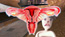 fallopian moth

